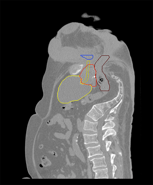 Patient treated feet first