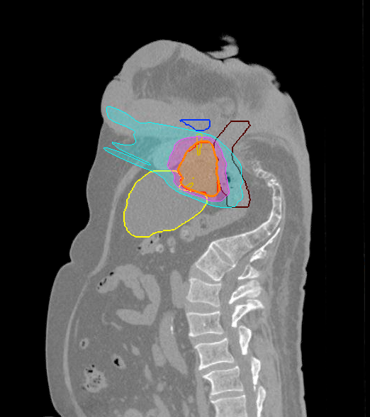 Patient treated feet first