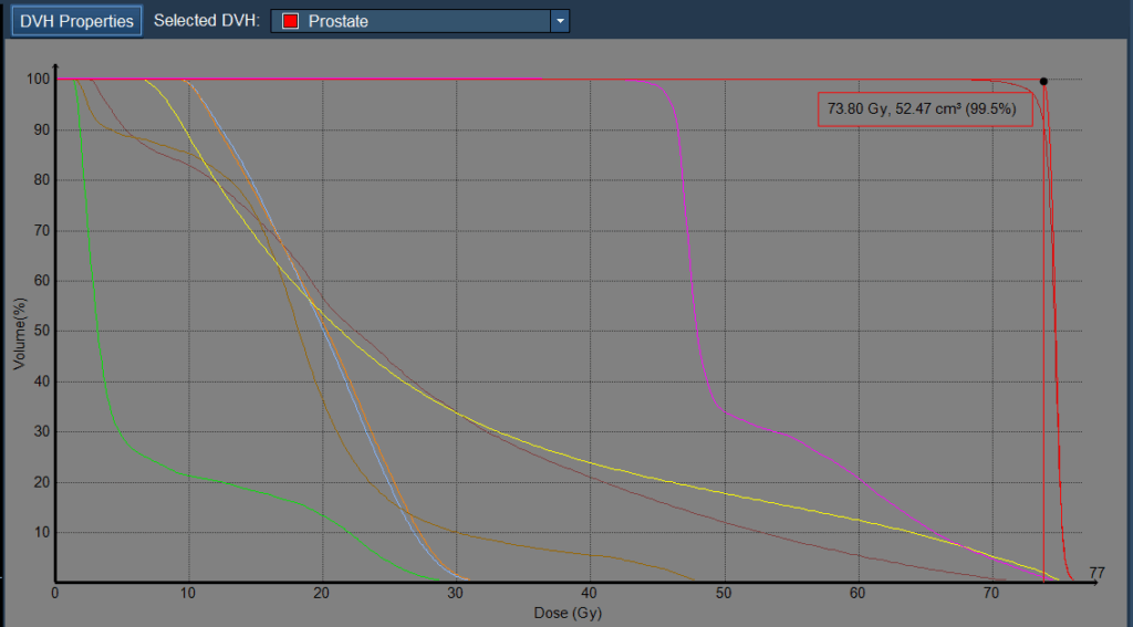 46+28 summation results - DVH
