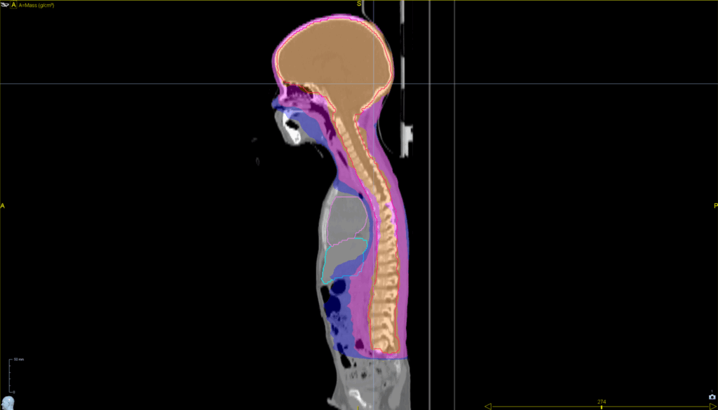 CSi_sag_iso - FOR SCREEN