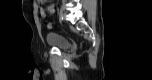 ClearRT Pelvis Male Sagittal