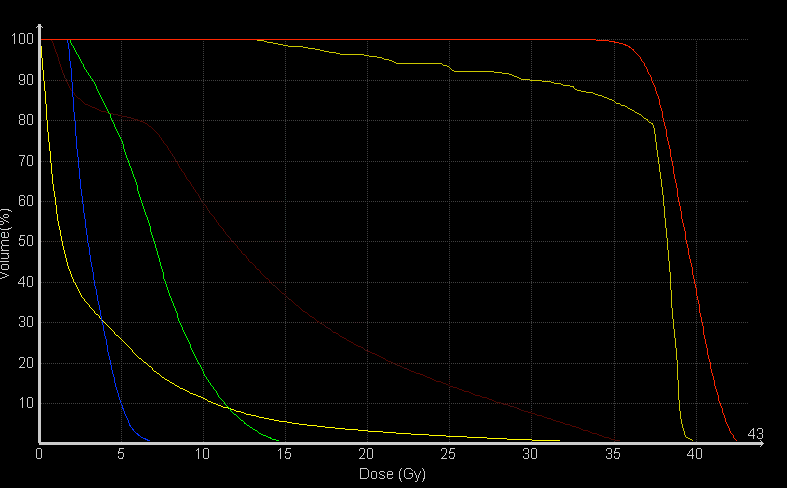 DVH Prostate SBRT CK