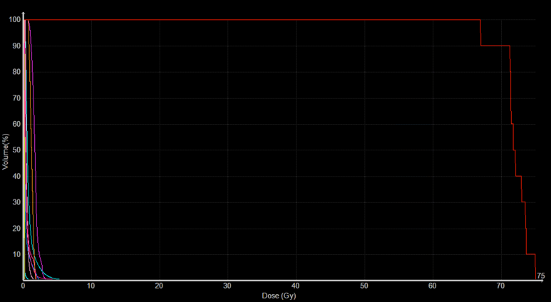 DVH Trigeminal Neuralgia