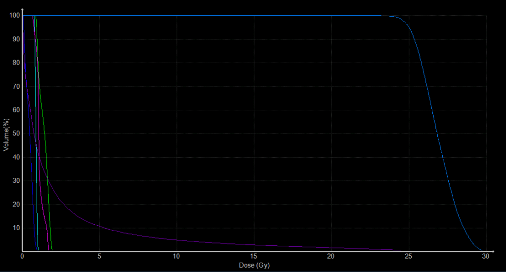 DVH brain meningioma