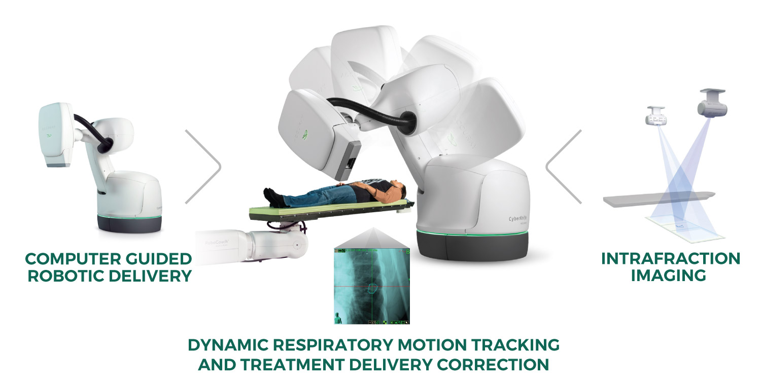 Accuray CyberKnife Dynamic SBRT Lung Tracking