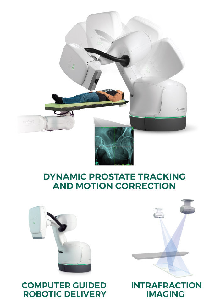 Accuray CyberKnife Prostate