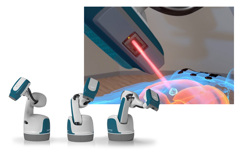The CyberKnife S7 System equips treatment teams with best-in-class precision and accuracy
