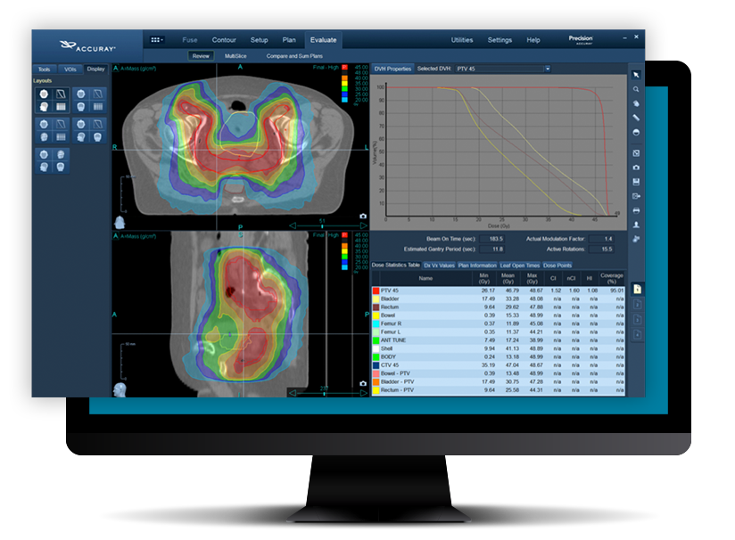 accuray precision treatment planning precise innovative tumor accuray incorporated