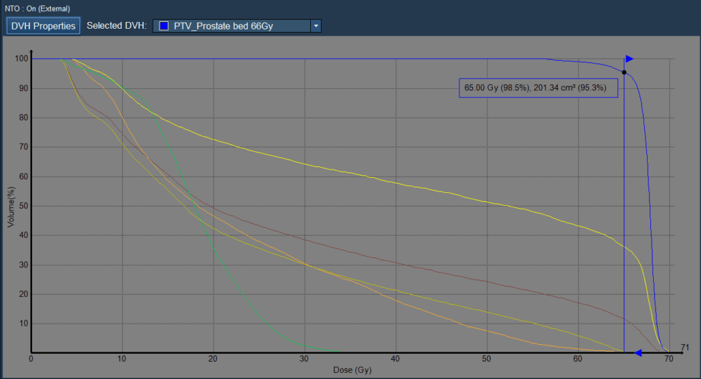 prostate bed DVH